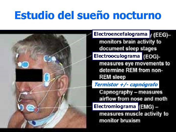 Estudio del sueño nocturno Electroencefalograma Electrooculograma Termistor +/- capnógrafo Electromiograma 