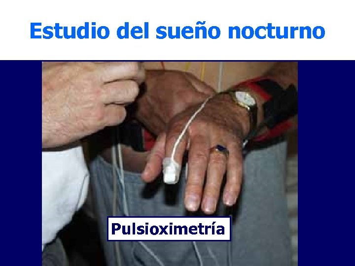 Estudio del sueño nocturno Pulsioximetría 