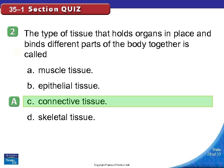 35– 1 The type of tissue that holds organs in place and binds different