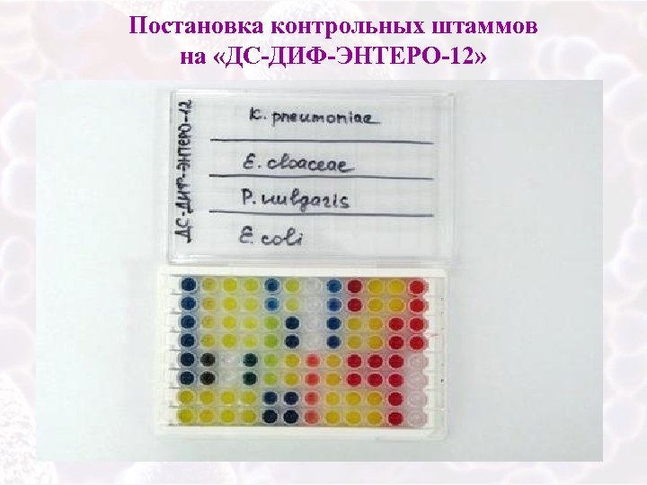 Постановка контрольных штаммов на «ДС-ДИФ-ЭНТЕРО-12» 