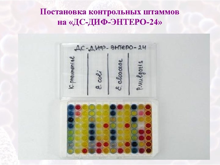 Постановка контрольных штаммов на «ДС-ДИФ-ЭНТЕРО-24» 