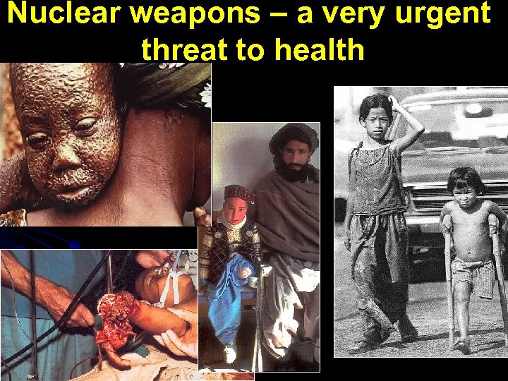 Nuclear weapons – a very urgent threat to health 