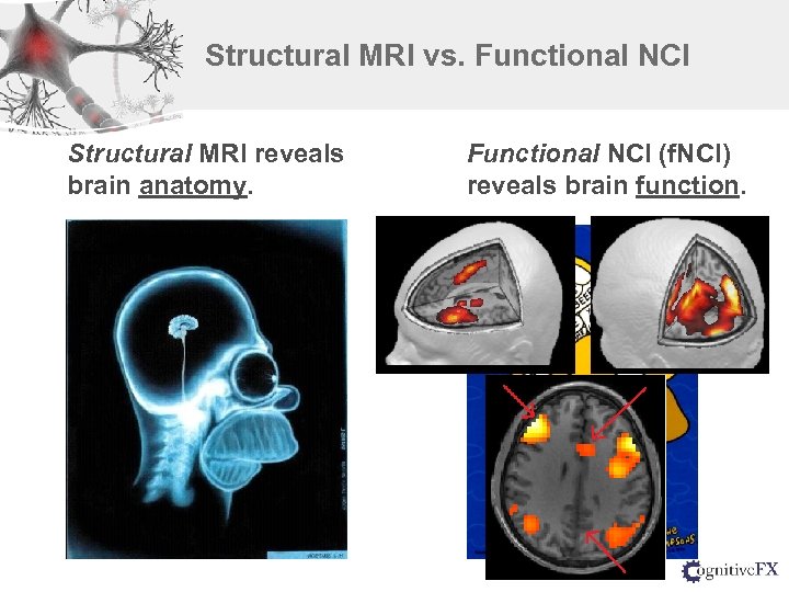 Structural MRI vs. Functional NCI Structural MRI reveals brain anatomy. Functional NCI (f. NCI)