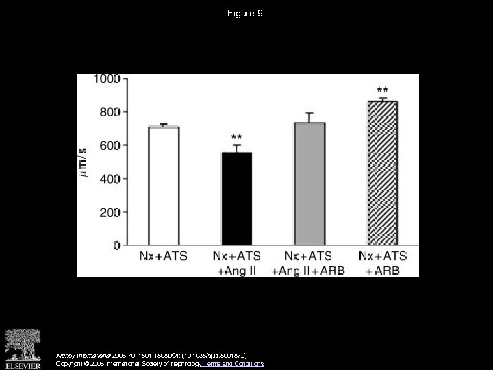 Figure 9 Kidney International 2006 70, 1591 -1598 DOI: (10. 1038/sj. ki. 5001872) Copyright