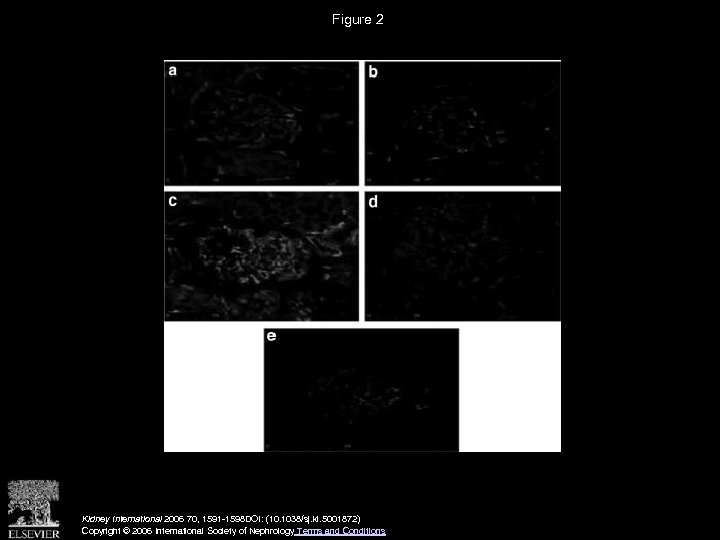 Figure 2 Kidney International 2006 70, 1591 -1598 DOI: (10. 1038/sj. ki. 5001872) Copyright