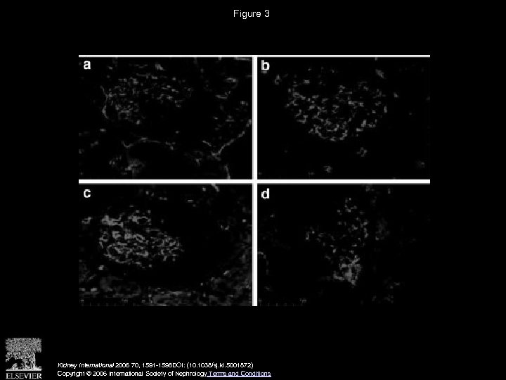 Figure 3 Kidney International 2006 70, 1591 -1598 DOI: (10. 1038/sj. ki. 5001872) Copyright