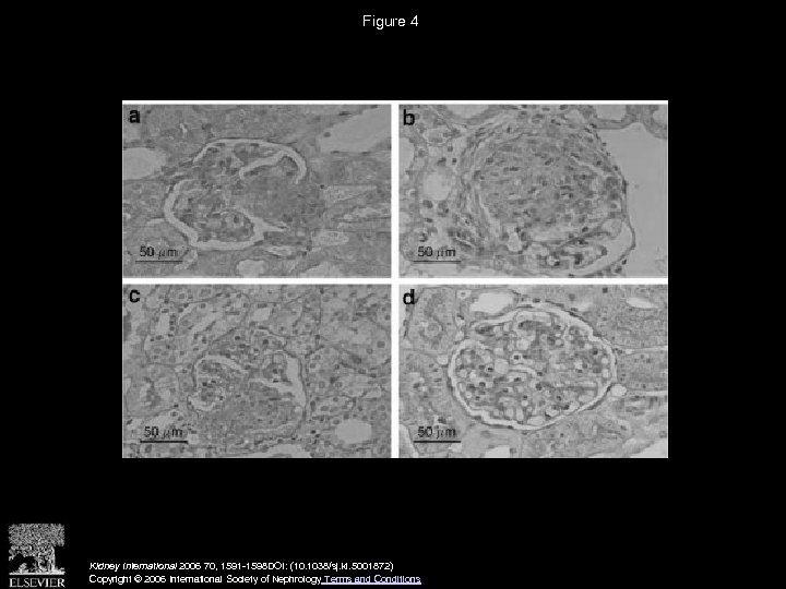 Figure 4 Kidney International 2006 70, 1591 -1598 DOI: (10. 1038/sj. ki. 5001872) Copyright