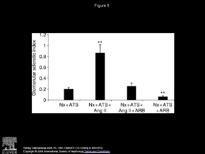 Figure 6 Kidney International 2006 70, 1591 -1598 DOI: (10. 1038/sj. ki. 5001872) Copyright
