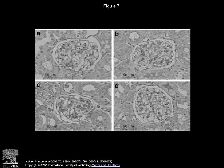 Figure 7 Kidney International 2006 70, 1591 -1598 DOI: (10. 1038/sj. ki. 5001872) Copyright
