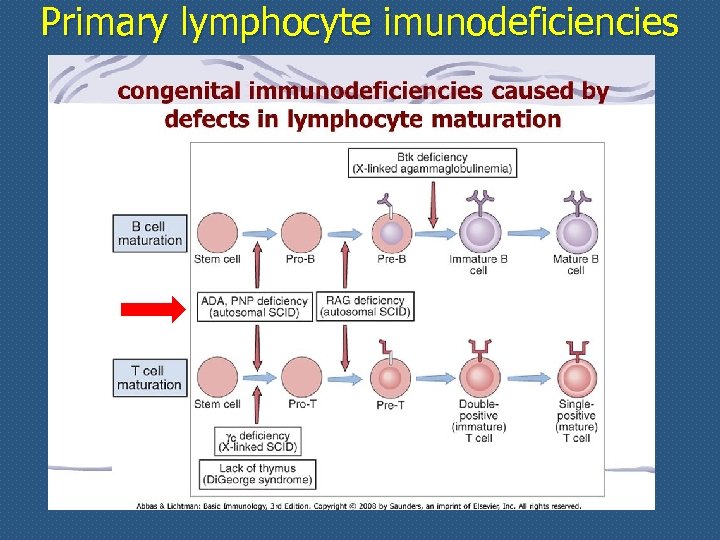 Primary lymphocyte imunodeficiencies 