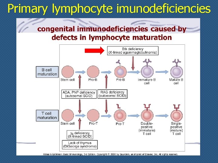 Primary lymphocyte imunodeficiencies 