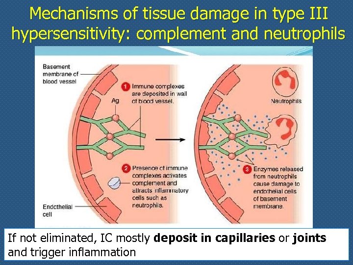 Mechanisms of tissue damage in type III hypersensitivity: complement and neutrophils If not eliminated,