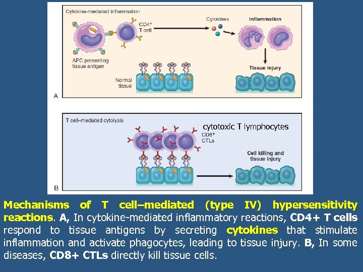 cytotoxic T lymphocytes Mechanisms of T cell–mediated (type IV) hypersensitivity reactions. A, In cytokine-mediated