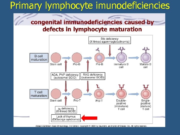 Primary lymphocyte imunodeficiencies 