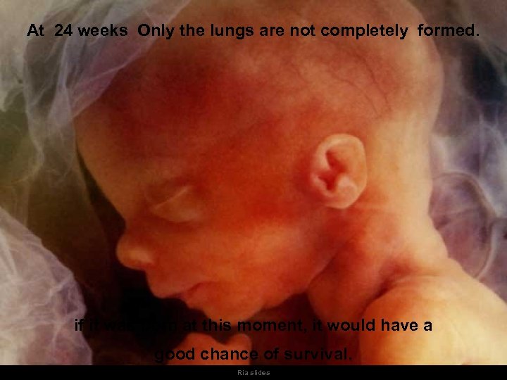 At 24 weeks Only the lungs are not completely formed. if it was born