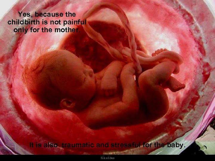 Yes, because the childbirth is not painful only for the mother. It is also