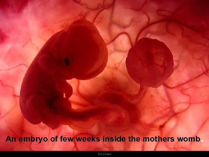 An embryo of few weeks inside the mothers womb. Ria slides 