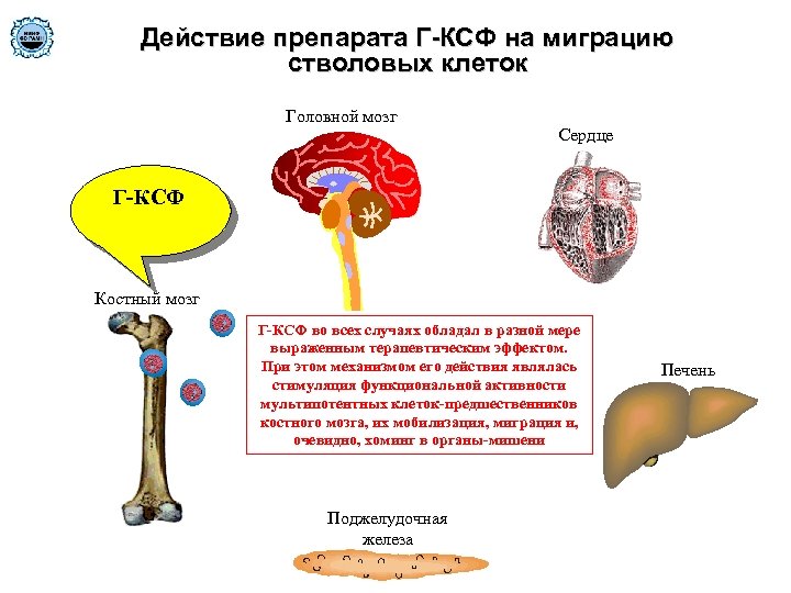 Действие препарата Г-КСФ на миграцию стволовых клеток Головной мозг Сердце Г-КСФ Костный мозг Г-КСФ