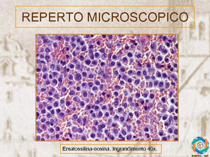 REPERTO MICROSCOPICO Ematossilina-eosina. Ingrandimento 40 x. 