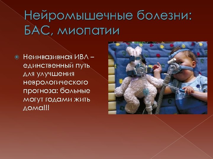 Нейромышечные болезни: БАС, миопатии Неинвазивная ИВЛ – единственный путь для улучшения неврологического прогноза: больные