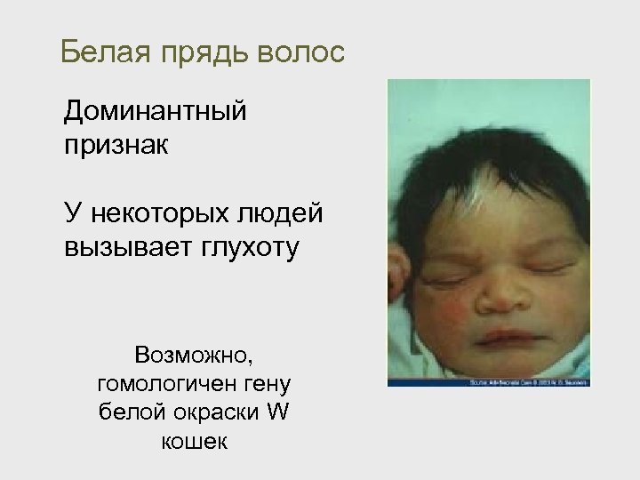 Белая прядь волос Доминантный признак У некоторых людей вызывает глухоту Возможно, гомологичен гену белой