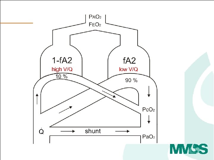 high V/Q low V/Q 