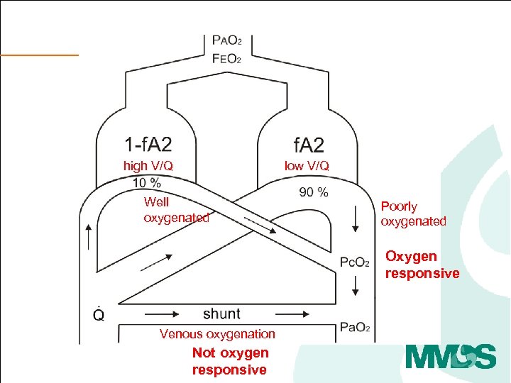 high V/Q low V/Q Well oxygenated Poorly oxygenated Oxygen responsive Venous oxygenation Not oxygen
