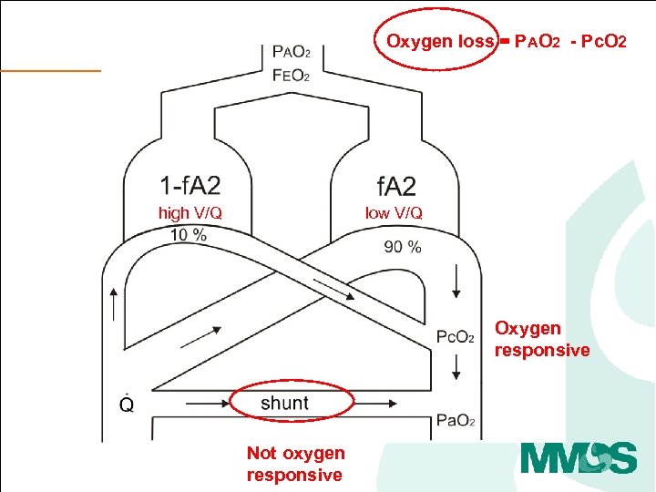 Oxygen loss = PAO 2 - Pc. O 2 high V/Q low V/Q Oxygen