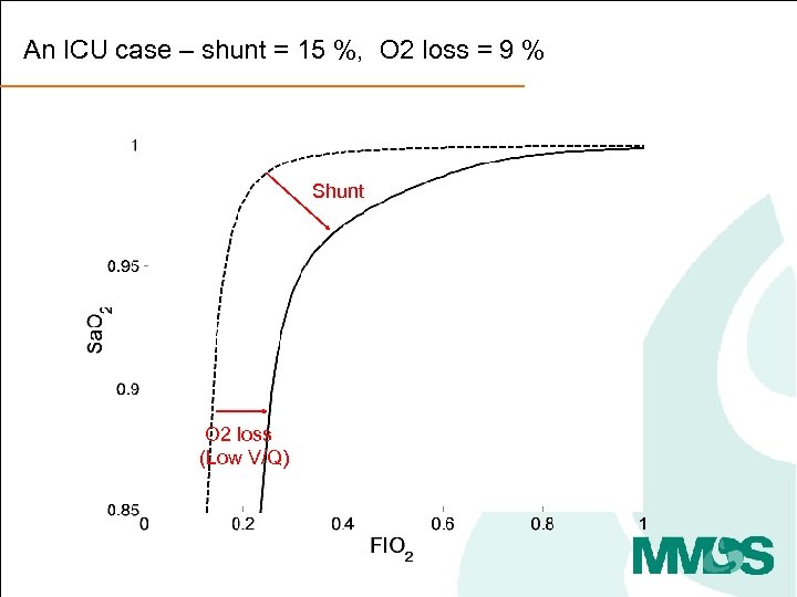 An ICU case – shunt = 15 %, O 2 loss = 9 %