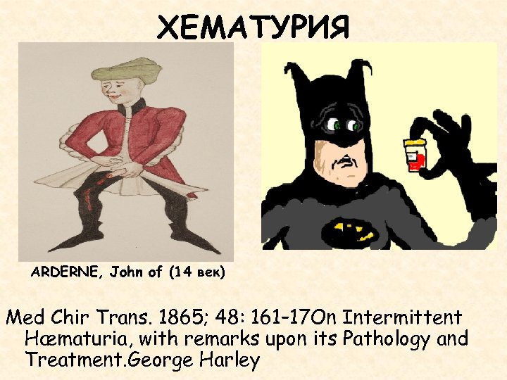 ХЕМАТУРИЯ ARDERNE, John of (14 век) Med Chir Trans. 1865; 48: 161– 17 On