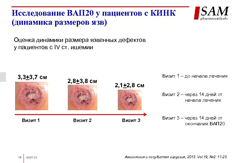Исследование ВАП 20 у пациентов с КИНК (динамика размеров язв) Оценка динамики размера язвенных