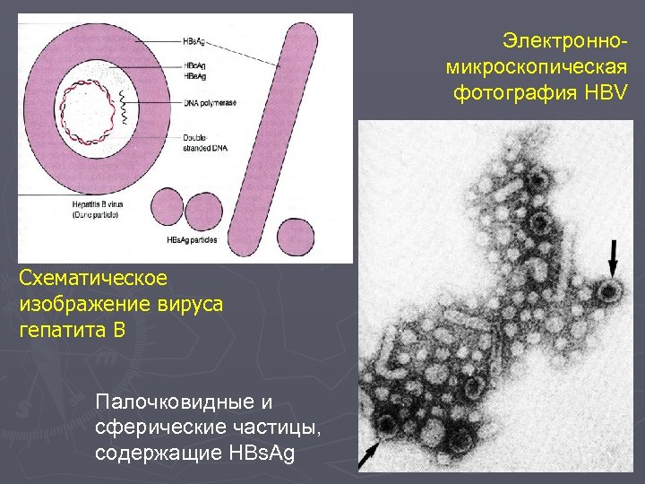 Электронномикроскопическая фотография HBV Схематическое изображение вируса гепатита В Палочковидные и сферические частицы, содержащие HBs.