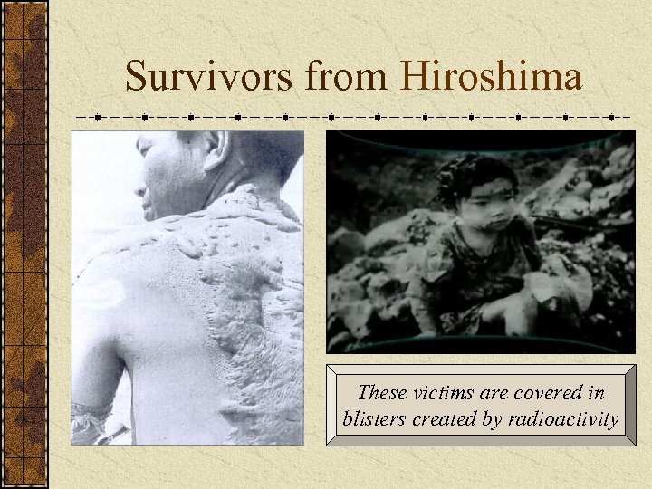 Survivors from Hiroshima These victims are covered in blisters created by radioactivity 