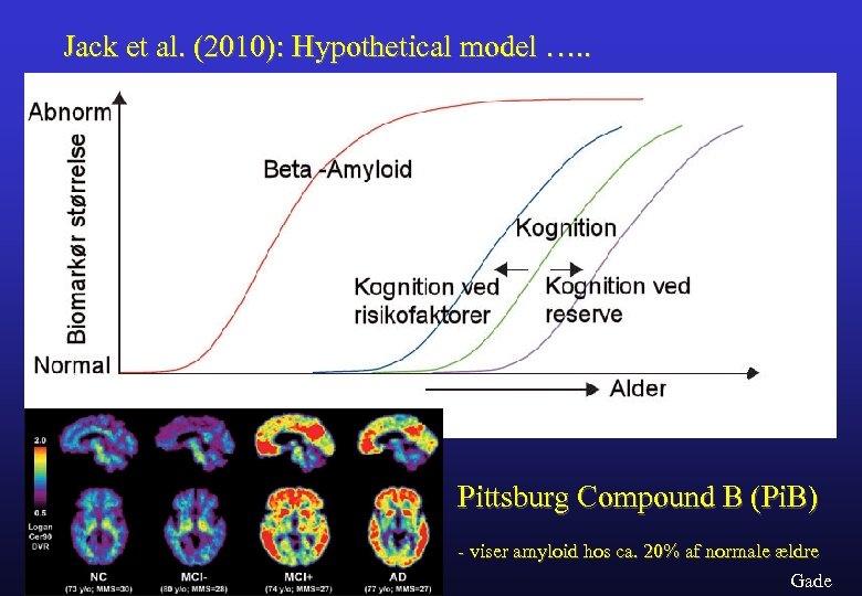 Jack et al. (2010): Hypothetical model …. . Pittsburg Compound B (Pi. B) -
