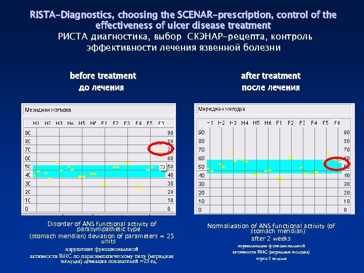 RISTA-Diagnostics, choosing the SCENAR-prescription, control of the effectiveness of ulcer disease treatment РИСТА диагностика,