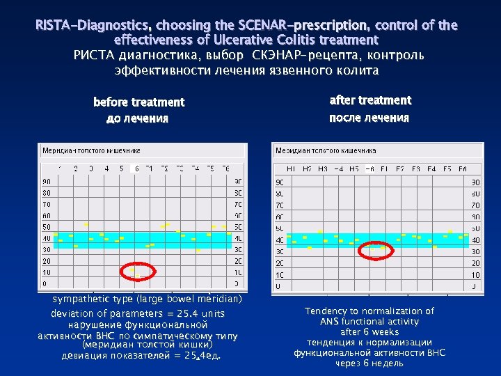 RISTA-Diagnostics, choosing the SCENAR-prescription, control of the effectiveness of Ulcerative Colitis treatment РИСТА диагностика,