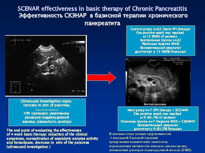 SCENAR effectiveness in basic therapy of Chronic Pancreatitis Эффективность СКЭНАР в базисной терапии хронического