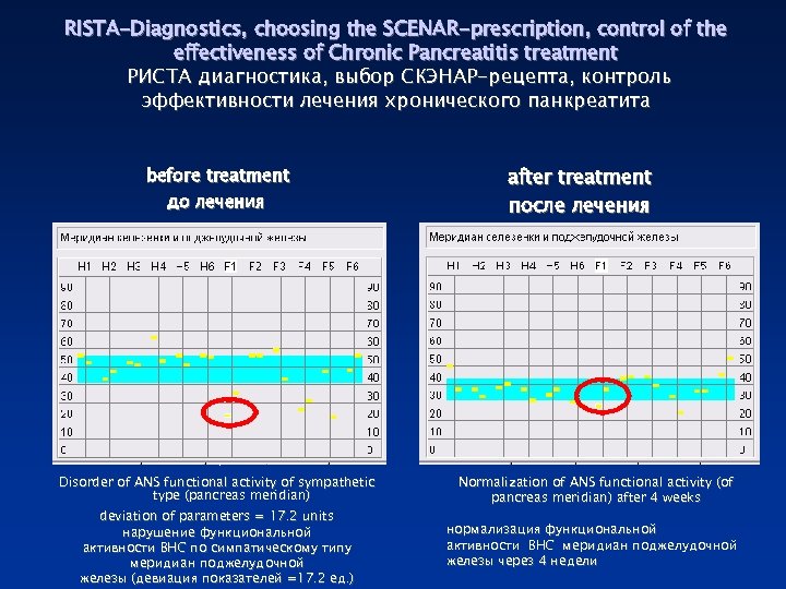 RISTA-Diagnostics, choosing the SCENAR-prescription, control of the effectiveness of Chronic Pancreatitis treatment РИСТА диагностика,