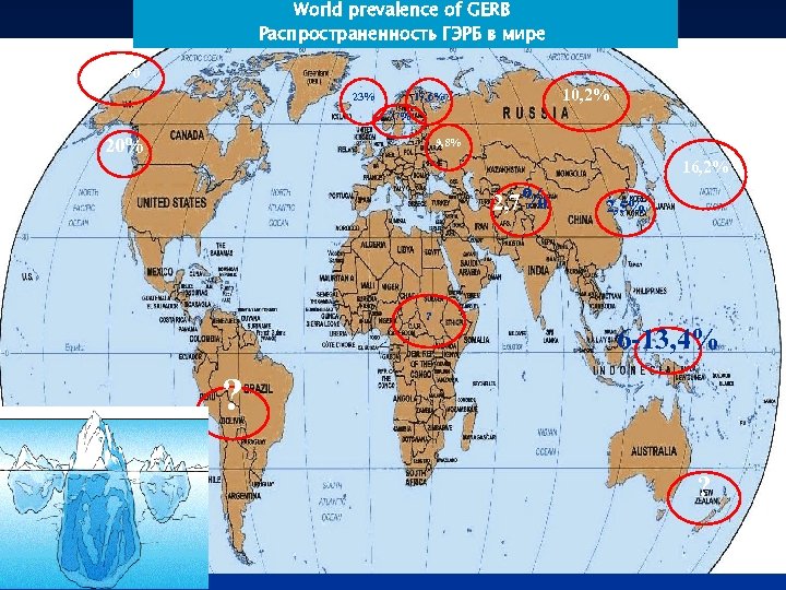 World prevalence of GERB Распространенность ГЭРБ в мире 14% 23% 10, 2% 17, 6%