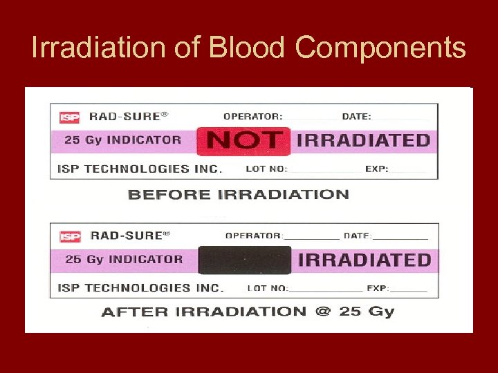 Irradiation of Blood Components 