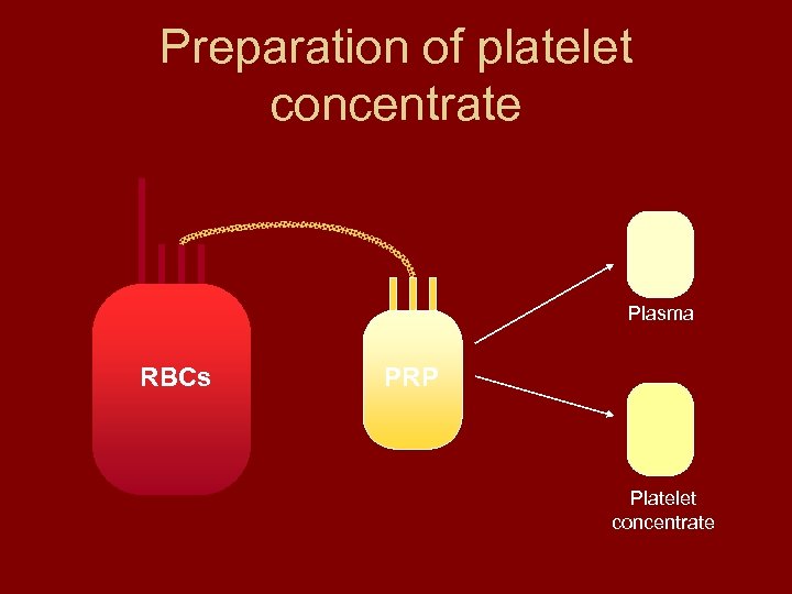 Preparation of platelet concentrate Plasma RBCs PRP Platelet concentrate 