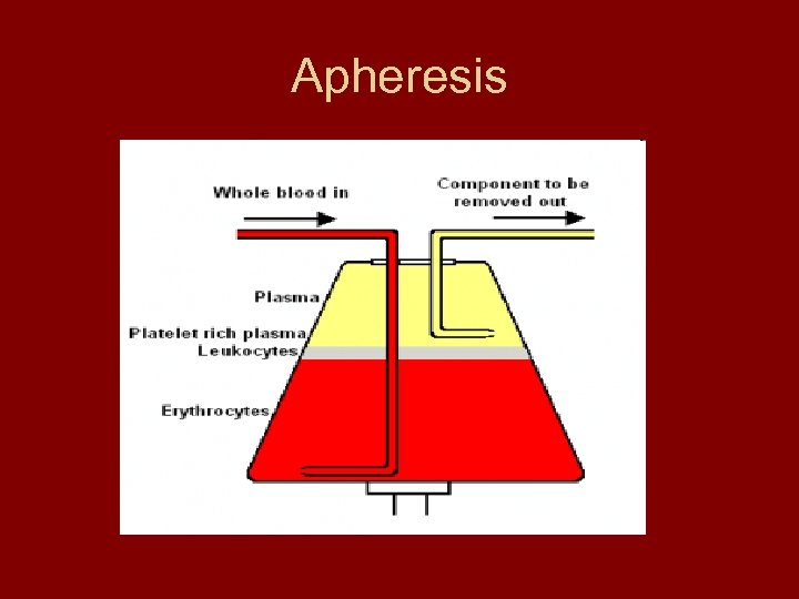 Apheresis 