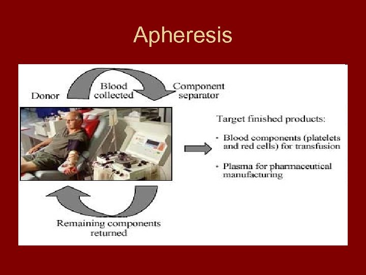 Apheresis 