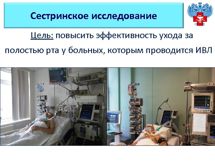 Сестринское исследование Цель: повысить эффективность ухода за полостью рта у больных, которым проводится ИВЛ