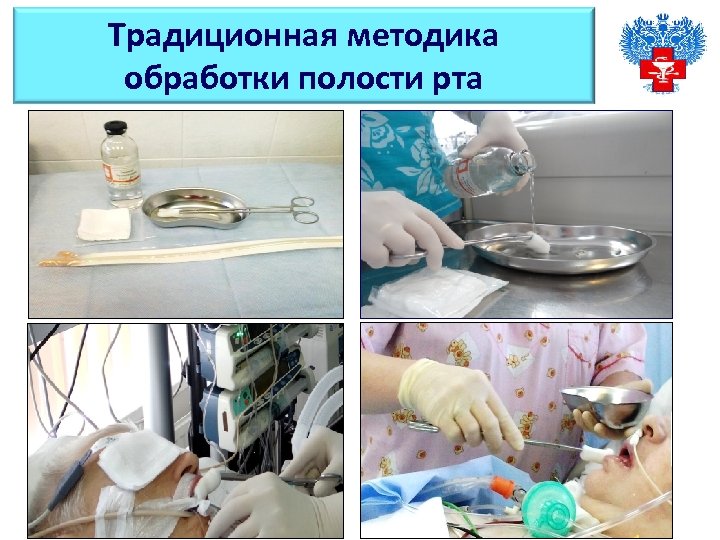 Традиционная методика обработки полости рта 