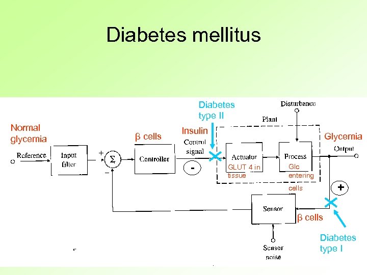 Diabetes mellitus Diabetes type II Normal glycemia β cells Insulin - Glycemia GLUT 4
