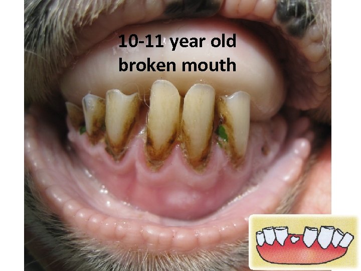 10 -11 year old broken mouth 