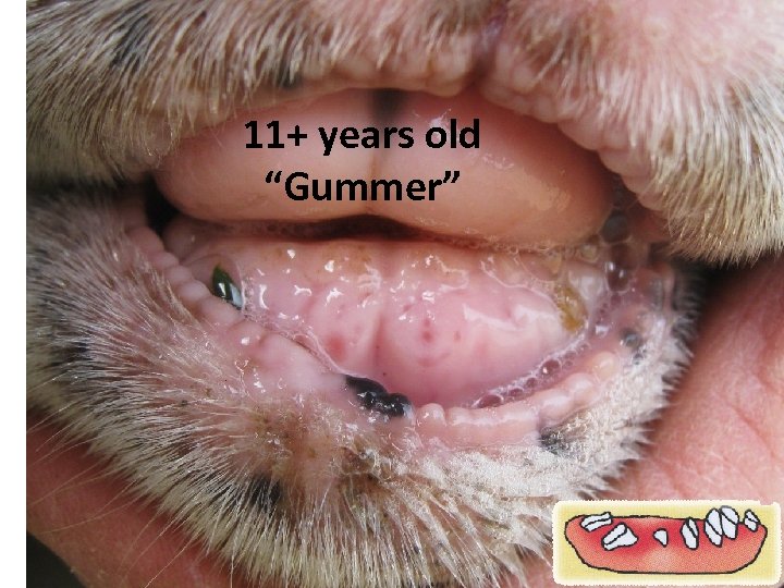 11+ years old “Gummer” 