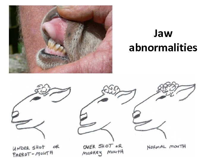 Jaw abnormalities 