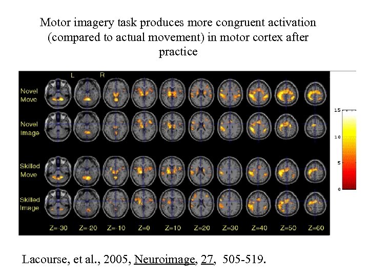 Motor imagery task produces more congruent activation (compared to actual movement) in motor cortex